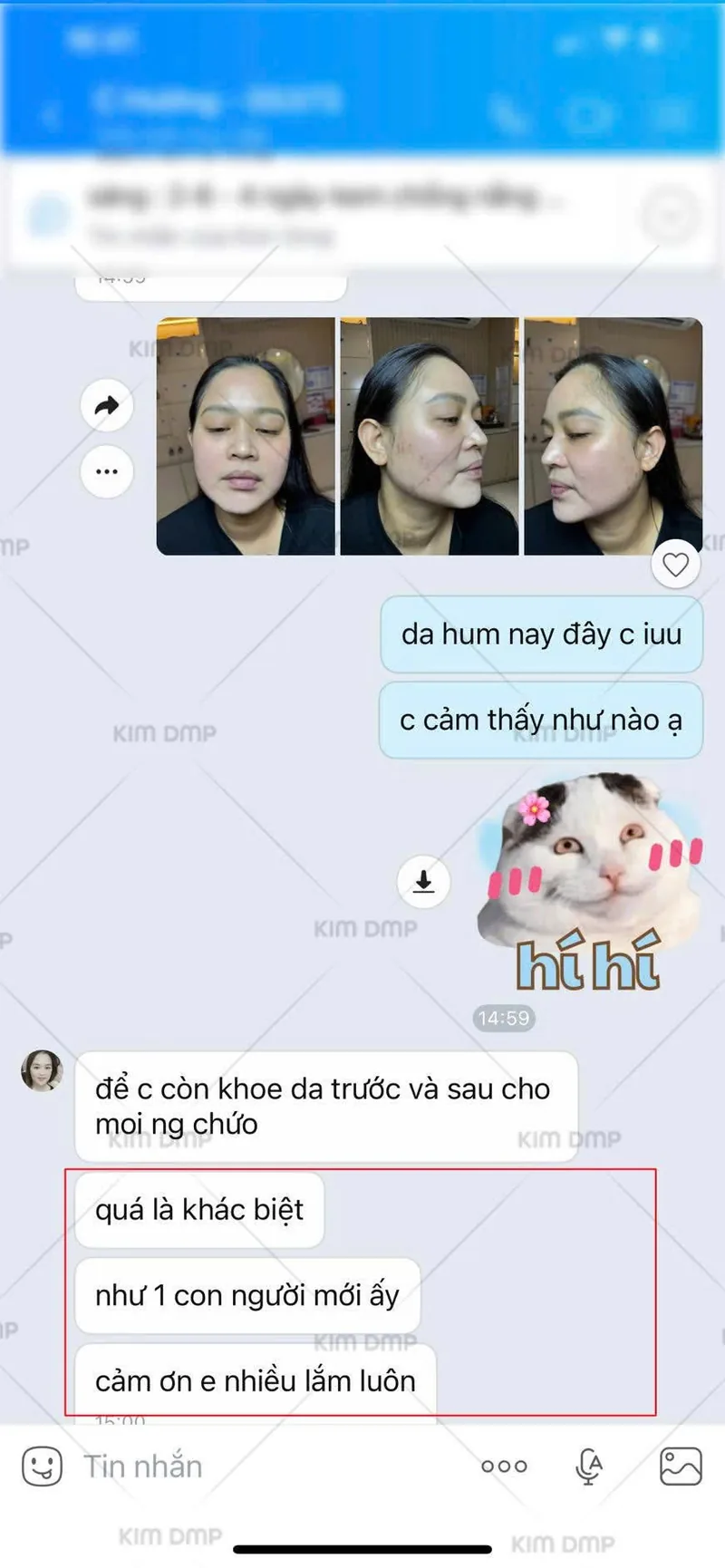 Khách hàng gửi lại hình ảnh da và phản hồi sau liệu trình tại Kim DMP