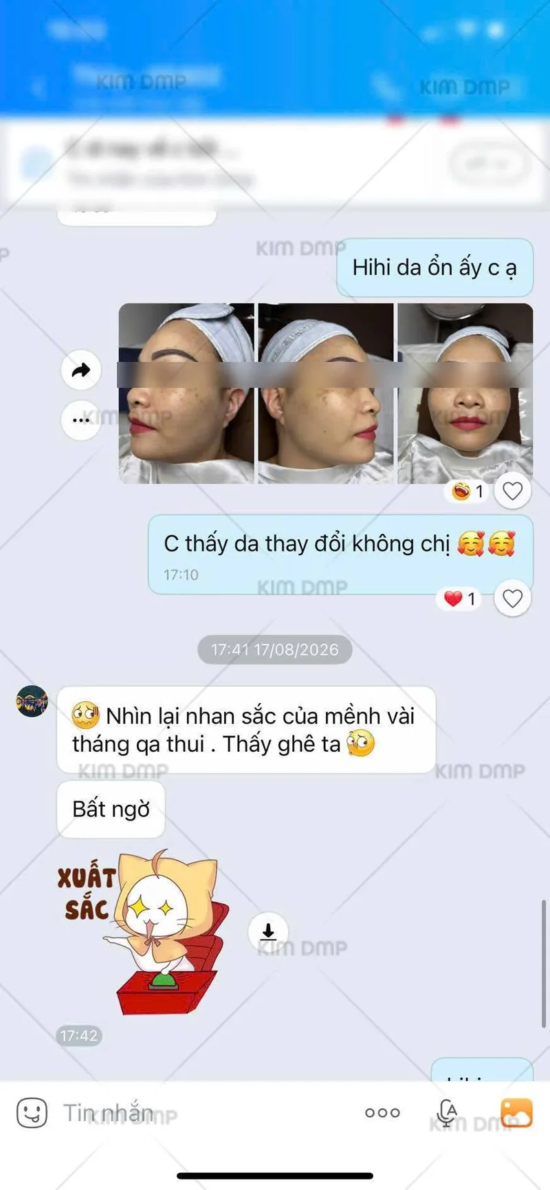 Khách hàng phản hồi bất ngờ về làn da sau vài tháng theo liệu trình
