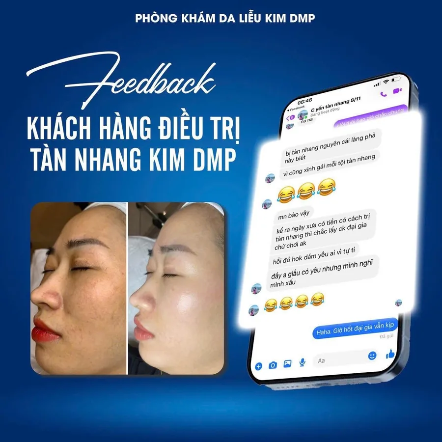 Phản hồi của khách hàng sau khi chăm sóc tàn nhang tại Kim DMP