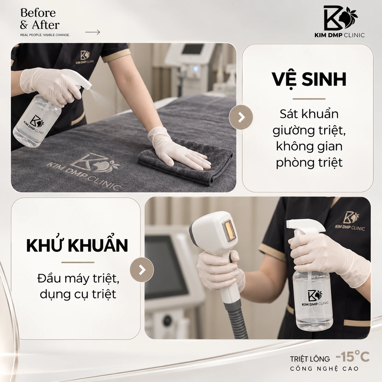 Quy trình vệ sinh và khử khuẩn giường, đầu máy, dụng cụ triệt lông tại Kim DMP