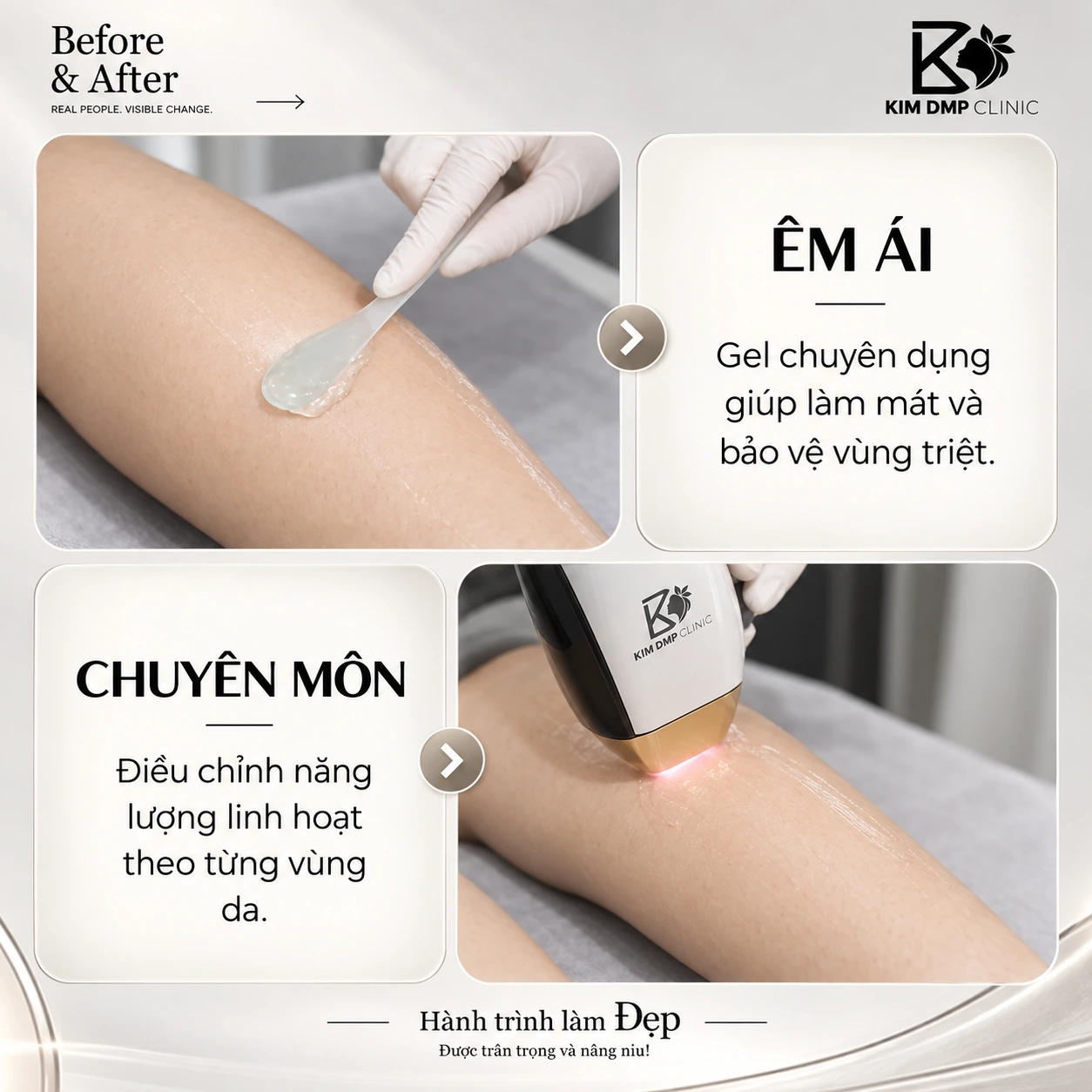 Gel chuyên dụng làm mát và điều chỉnh năng lượng theo từng vùng da